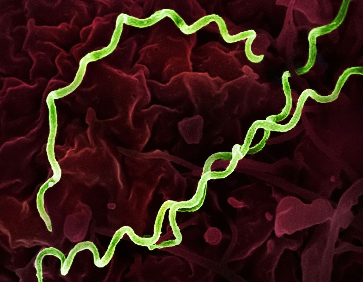 South Dakota has a syphilis problem