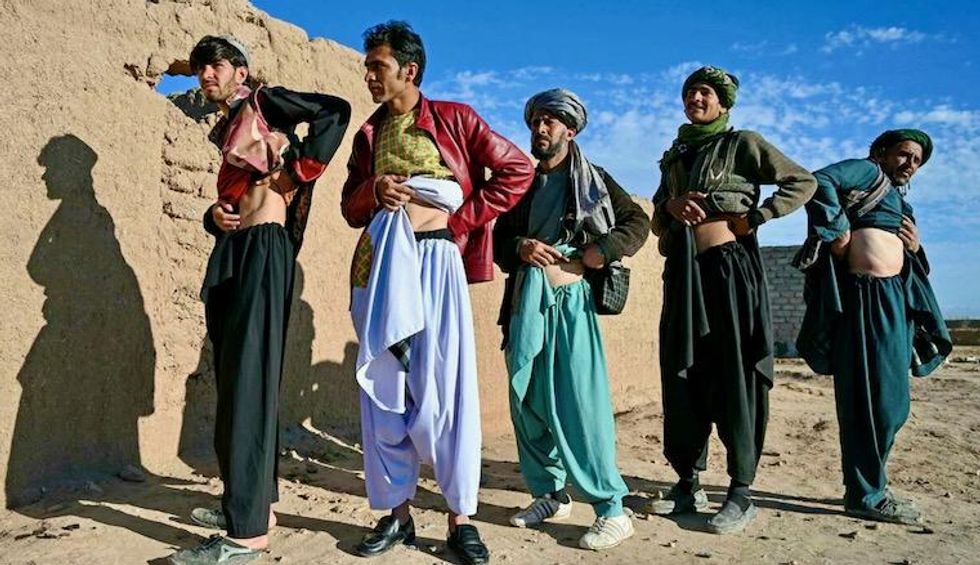 Desperate Afghans resort to selling their kidneys to feed families