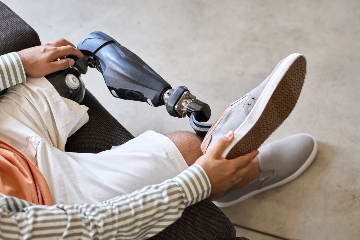 Health insurers limit coverage of prosthetic limbs doubting medical necessity