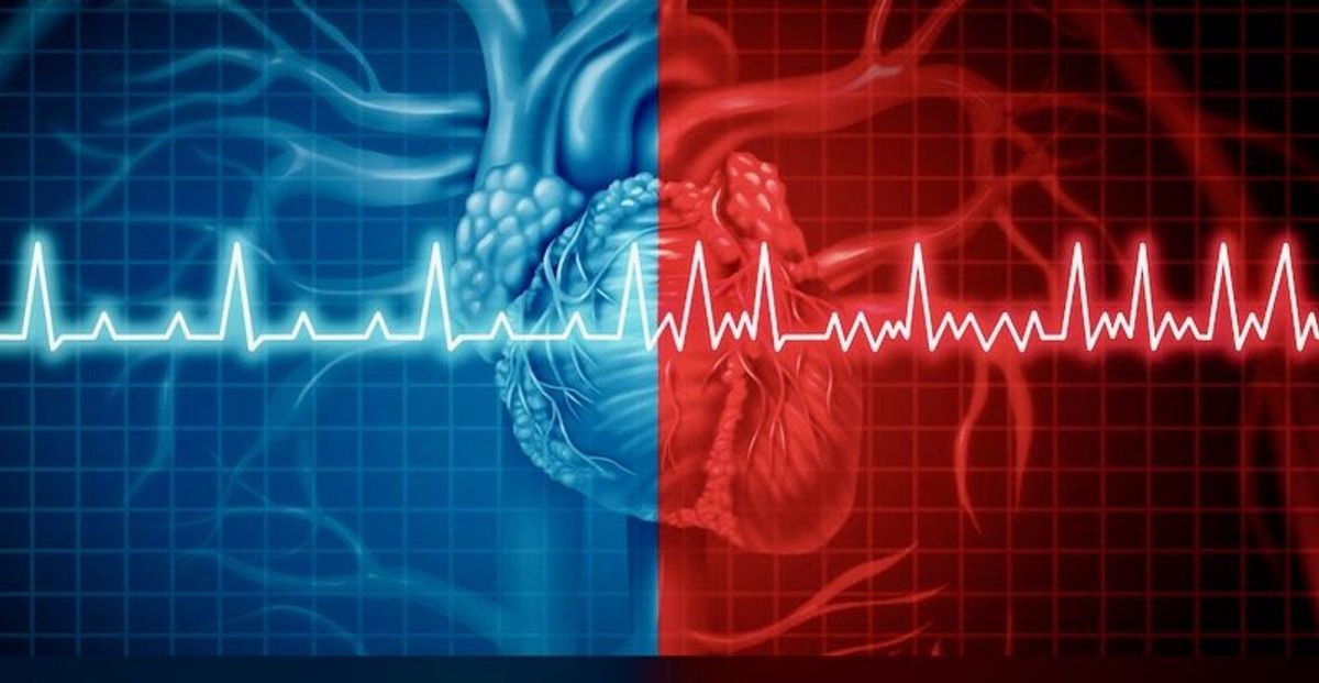 Why is obesity linked to irregular heart rhythms? Researchers found 1 potential mechanism