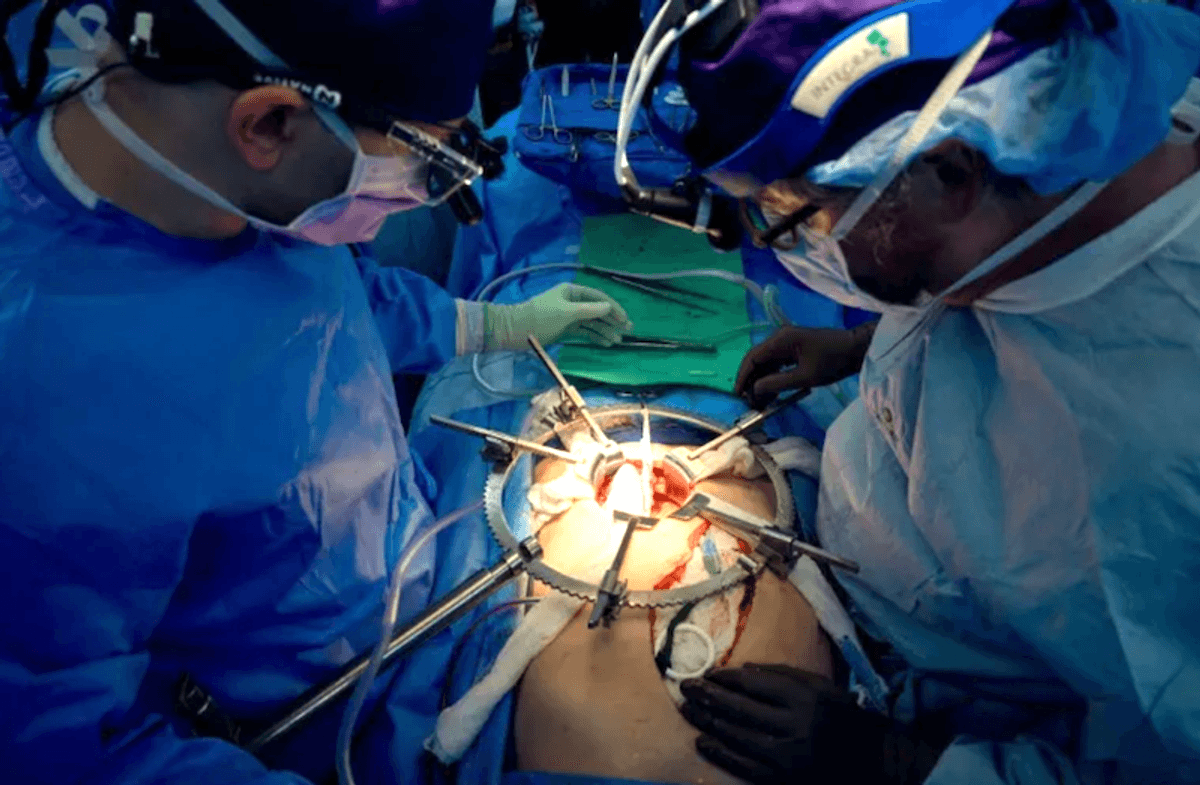 US surgeons say pig kidney functional in human for more than a month