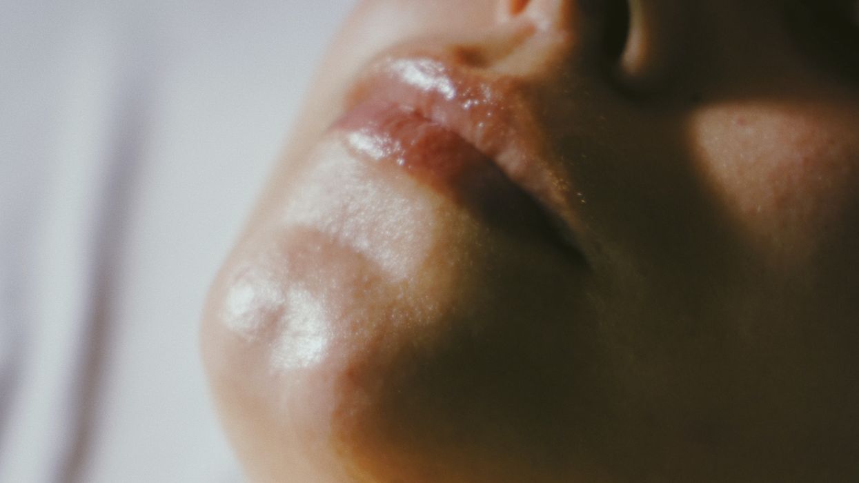 Another case of HIV linked to vampire facial offered at New Mexico medical spa