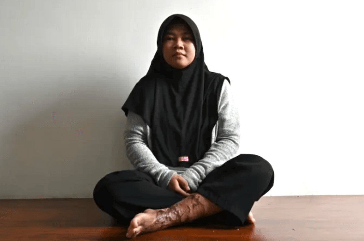 Indonesian maid's torture highlights lack of legal protections
