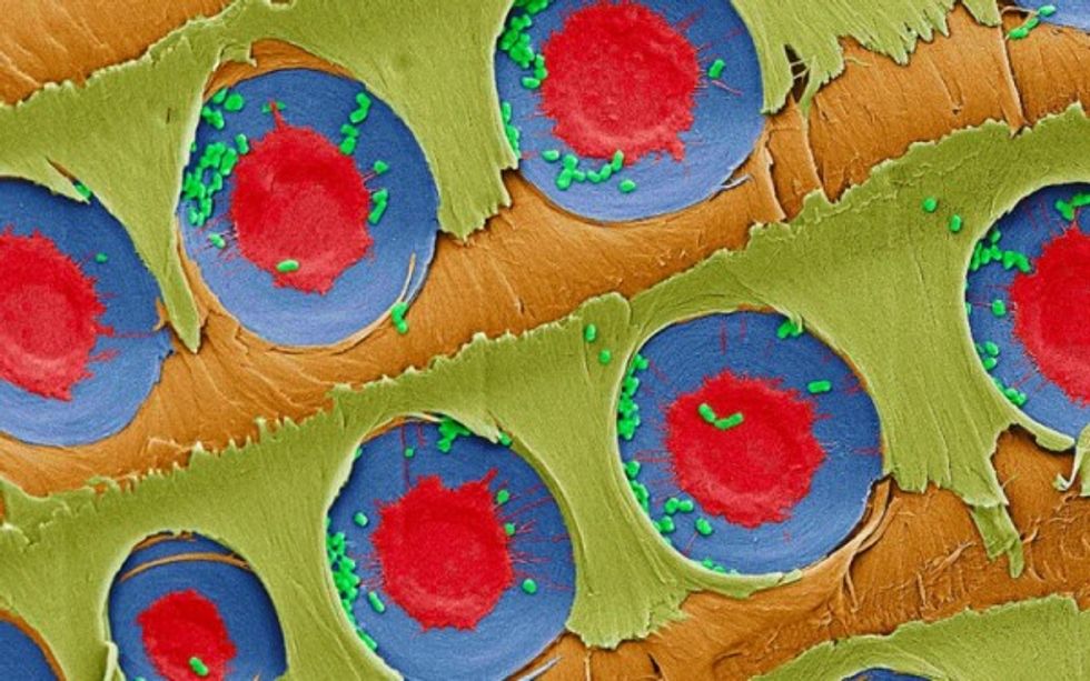 Tree branches make very effective improvised water filters: MIT researchers