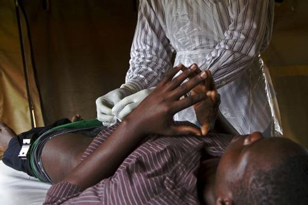 Uganda tests out rubber band circumcision in battle against HIV