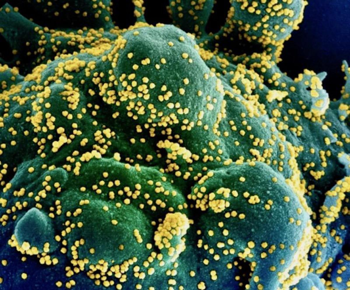 Lilly Covid antibodies cut hospitalizations and deaths