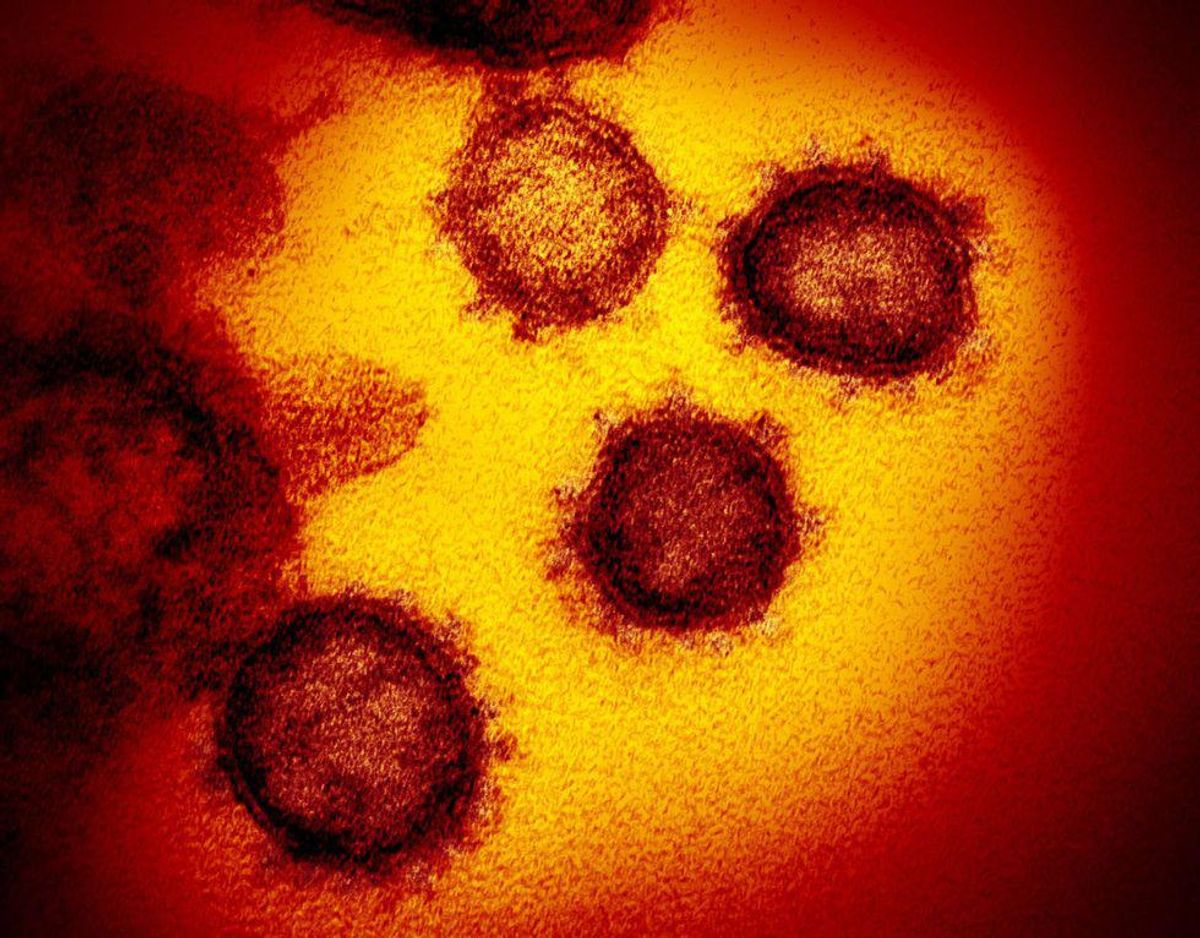 Everything we know about the mu variant -- the latest coronavirus mutation