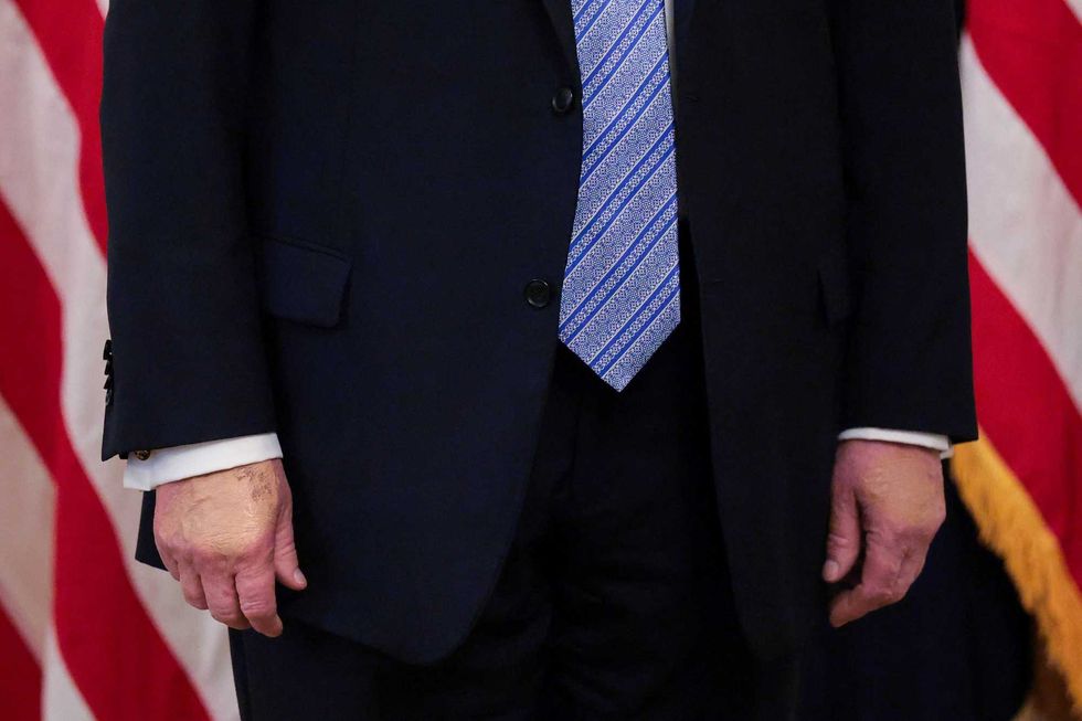 'What the hell is going on?' Trump's makeup-caked, bruised hands leaves observers aghast
