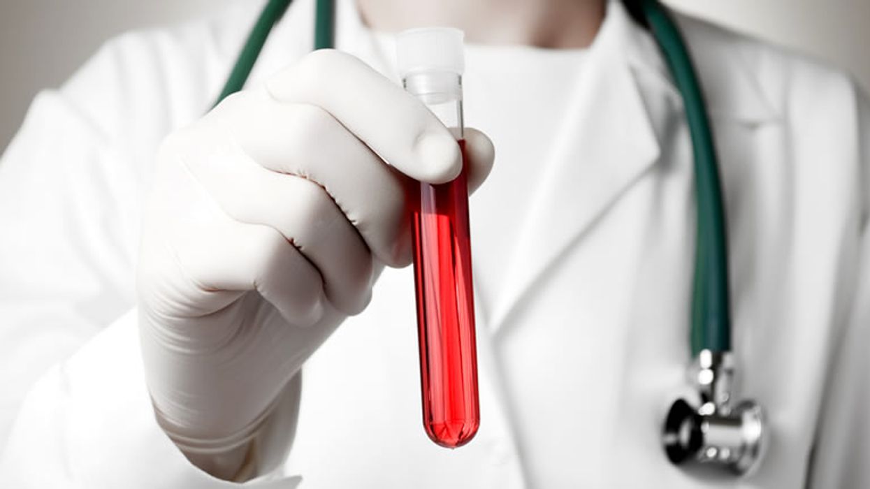 A blood test that screens for multiple cancers at once promises to boost early detection