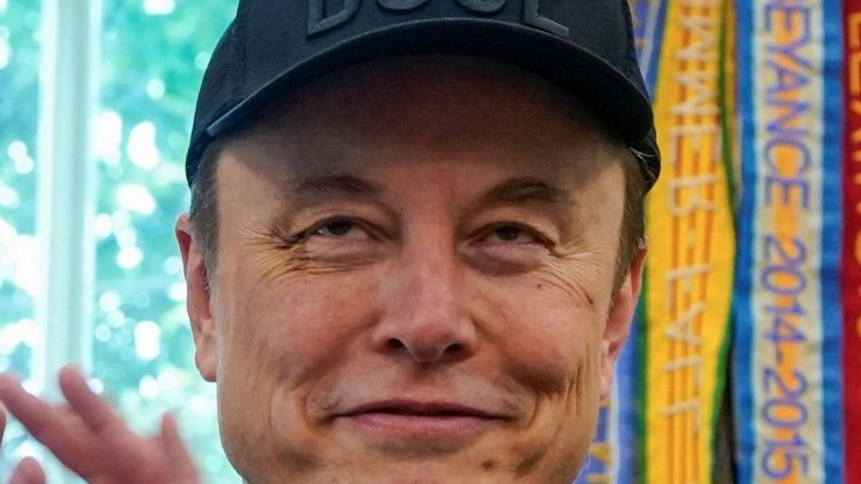 Elon Musk sports apparent black eye during Oval Office presentation