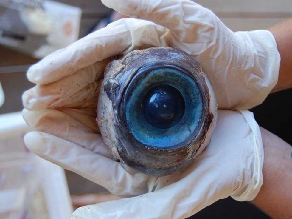 Giant eyeball
