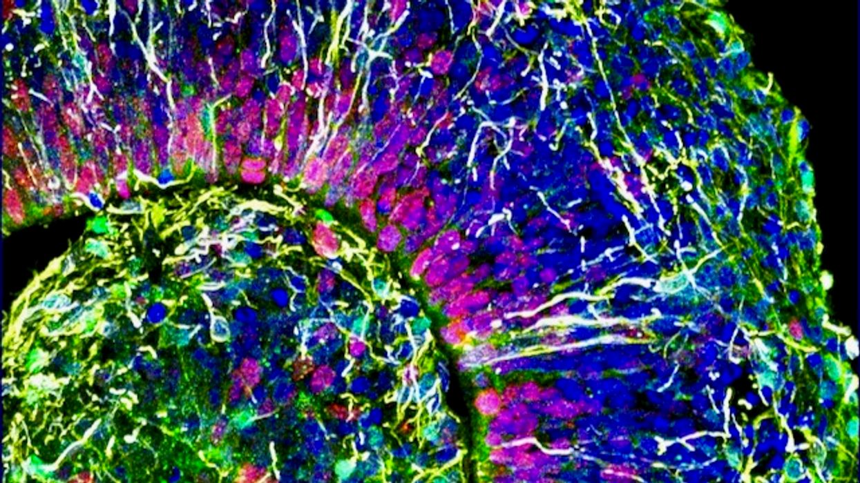 Here's what happens to your brain when you give up eating sugar