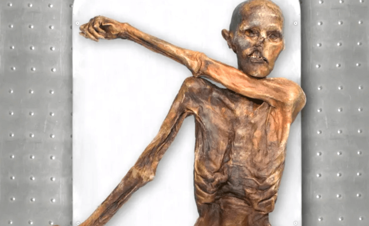 Iceman Oetzi was balding, darker-skinned than thought: study