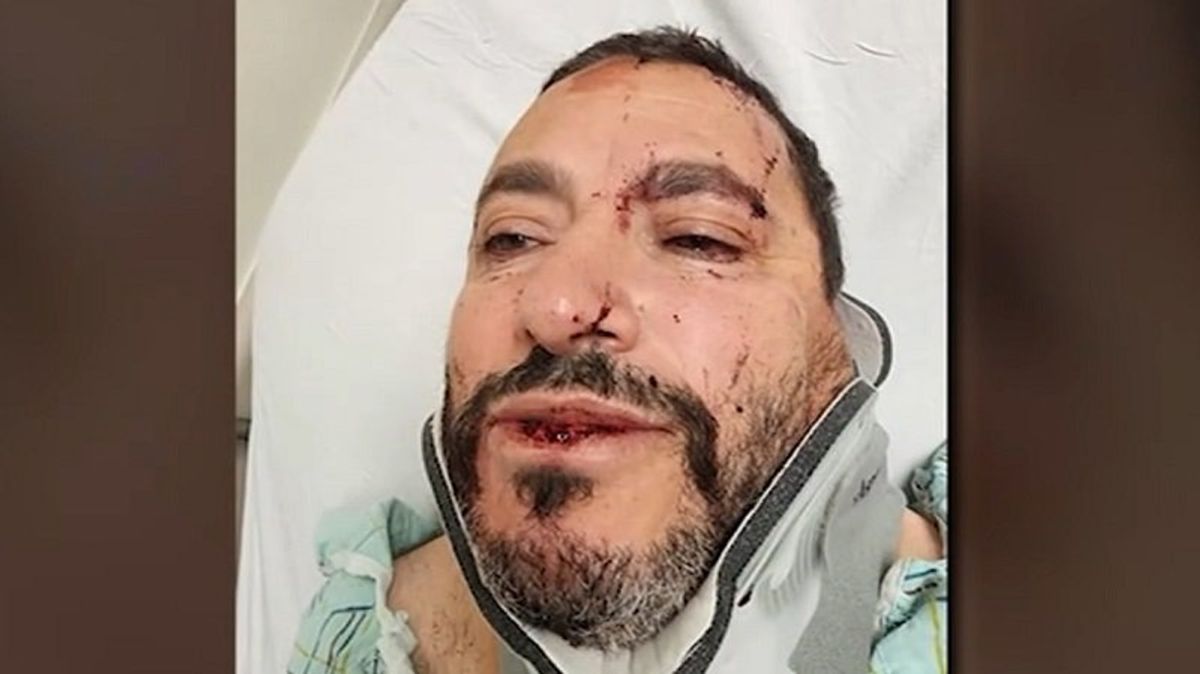 Yemeni convenience store owner suffers brutal metal pipe attack in possible hate crime