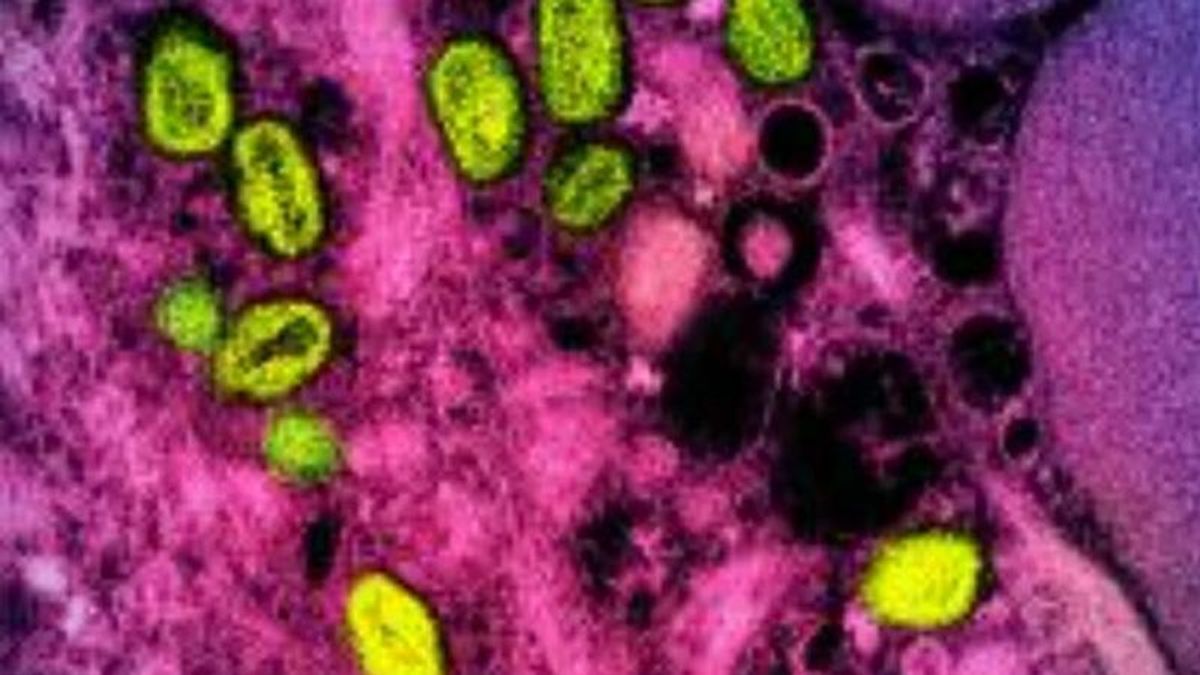 Second US monkeypox death as virus linked to brain inflammation
