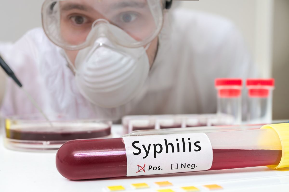 ‘An epidemic’: Syphilis rages through Texas, causing newborn cases to climb amid treatment shortage