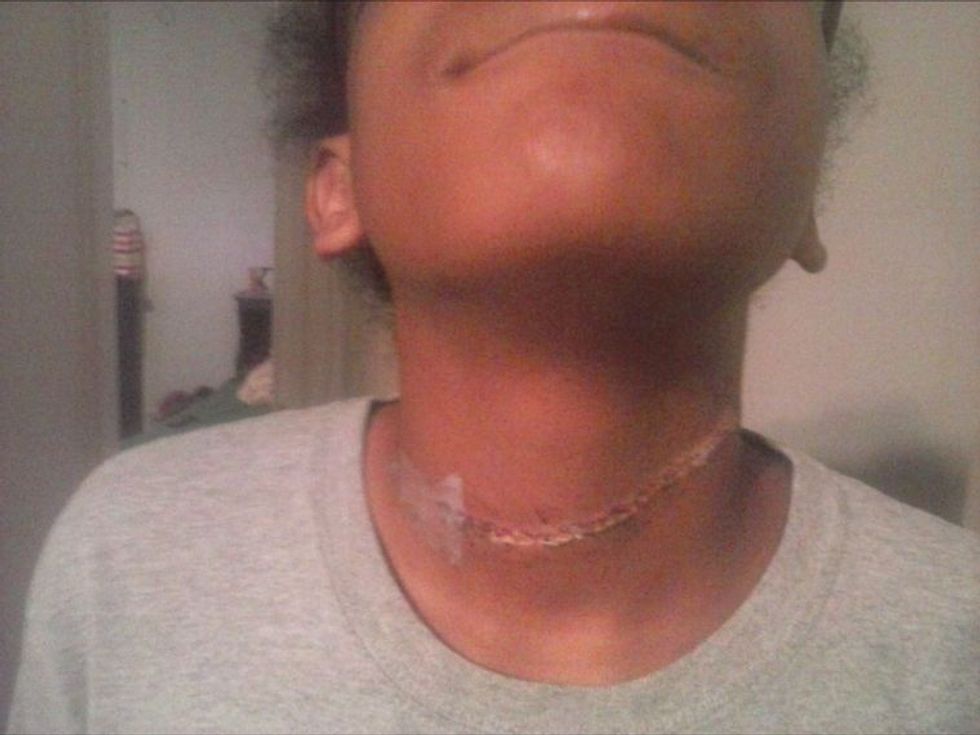 White boys put rope around black girl's neck and dragged her while school looked other way: lawsuit