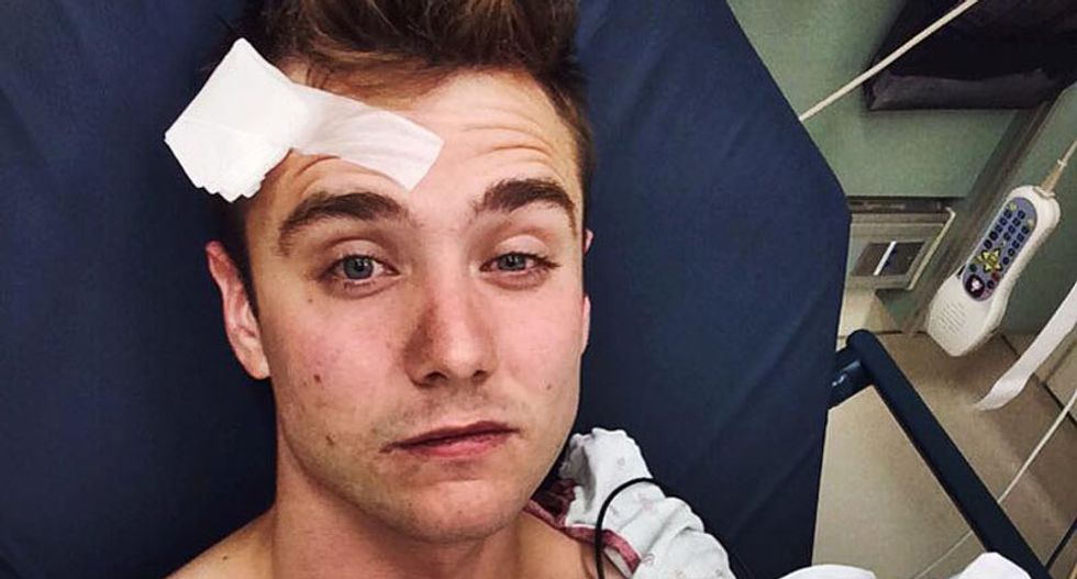 Gay viral video star Calum McSwiggan stalked and brutally beaten during pride weekend