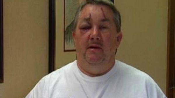 'Friendly Atheist' offers to help Ohio pastor allegedly beaten by 'militant atheist'