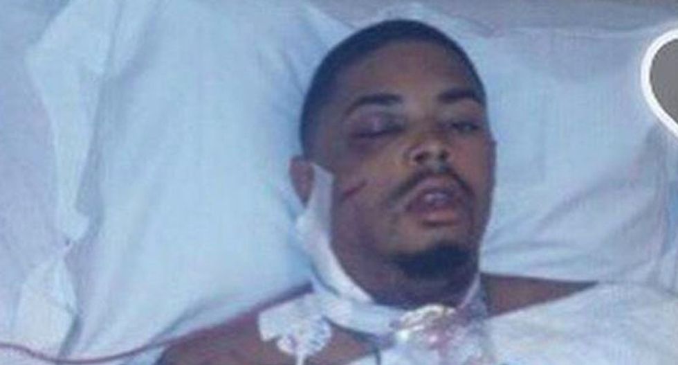 Black man shot in face by Baltimore cops acquitted after jury rejects police testimony