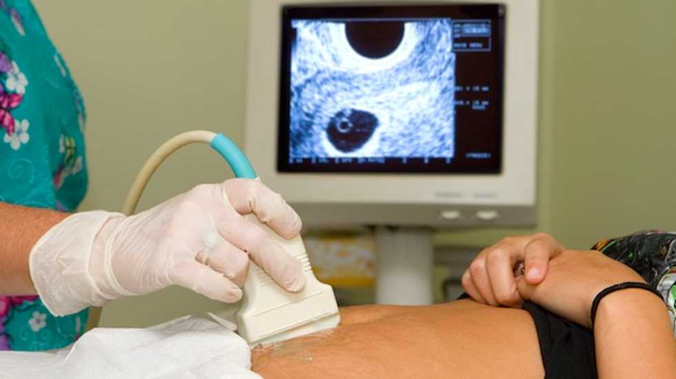 New Ohio law could create nation's largest metro area without an abortion clinic