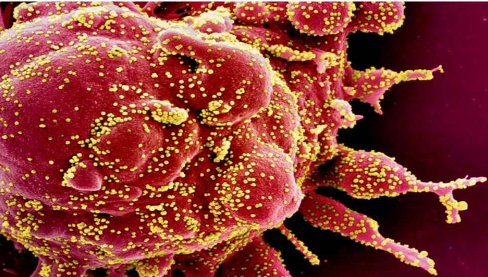 Zinc-hydroxychloroquine found effective in some COVID-19 patients: study