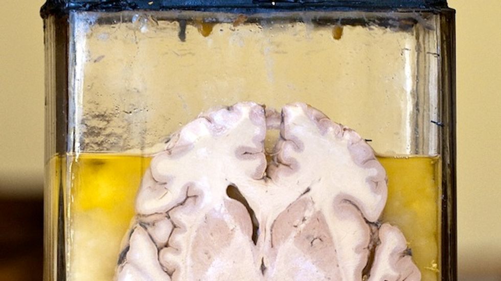 BrainStorm gets FDA fast-track status for ALS stem cell therapy