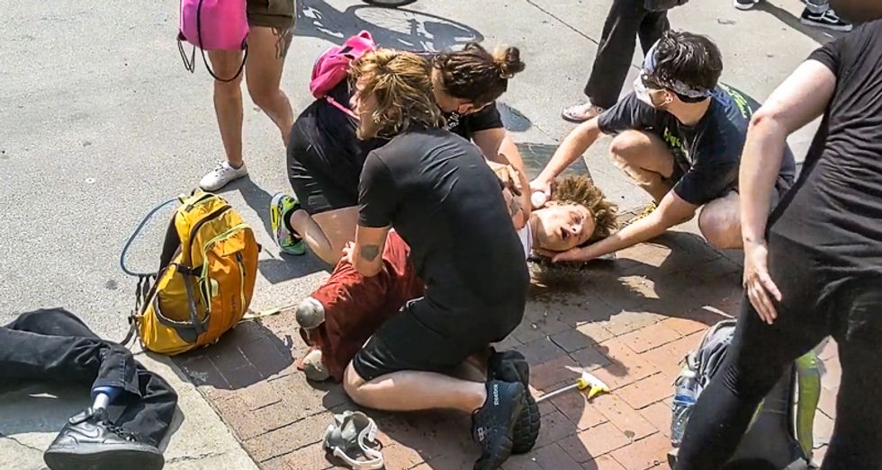 Columbus police accused of pepper-spraying double amputee and 'stealing' his prosthetic legs