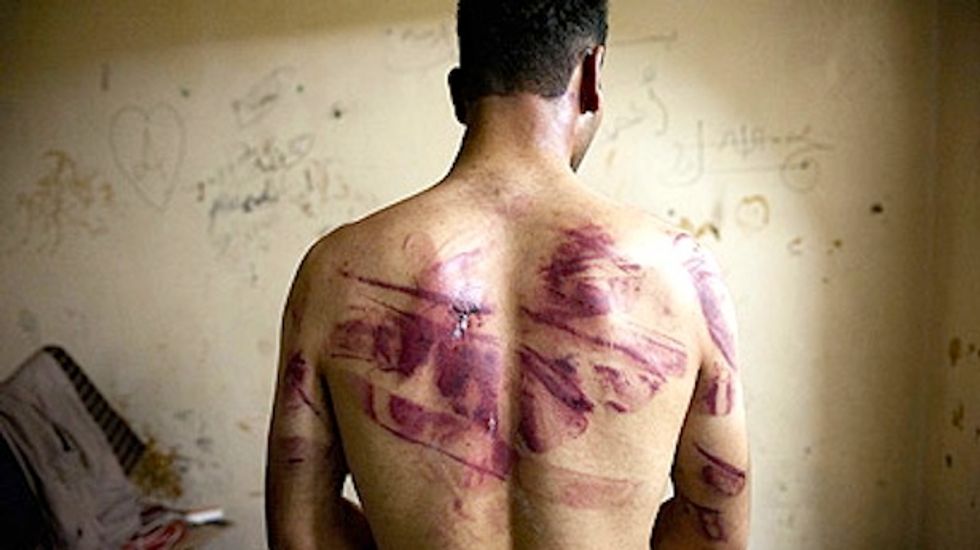 Obama administration knew of mass torture in Syria since November