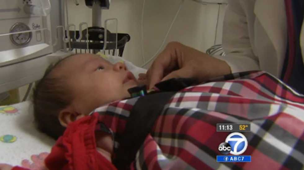 'Ghost white baby' born in California hospital with almost none of her blood