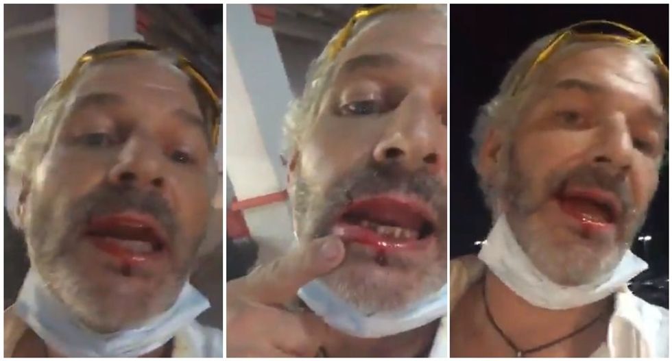 Man spits on grocery store worker who asked him to wear a mask -- and immediately gets hit in the face: police