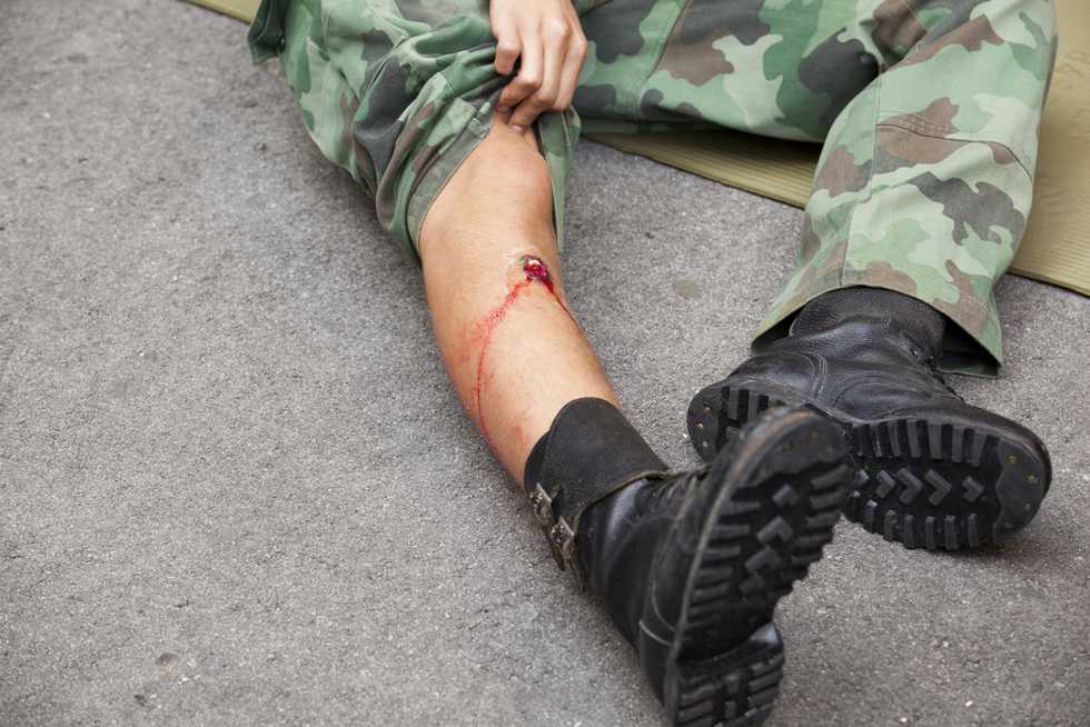 Florida man accidentally shoots self in leg after gun safety class
