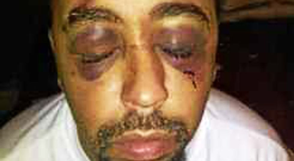 'They beat the crap out of him': New Jersey cops accused of breaking black man's jaw during traffic stop