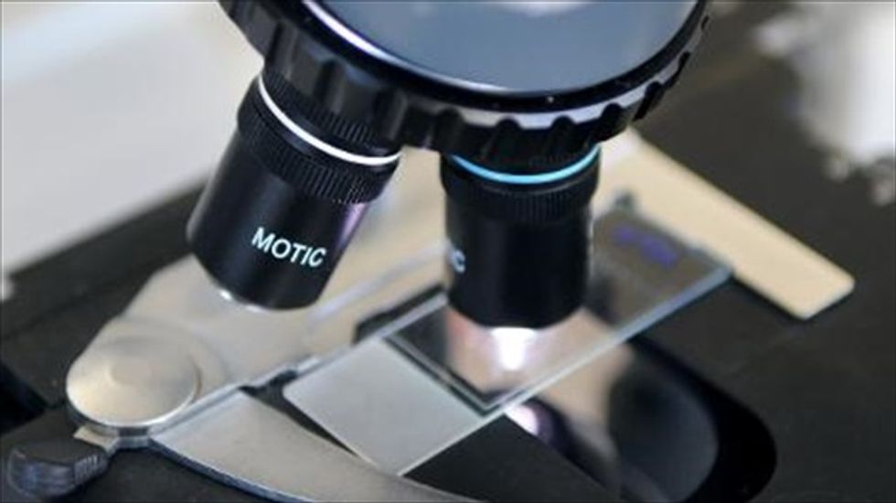 Researchers: T-cell 'scissors' treatment shows promise as HIV deterrent