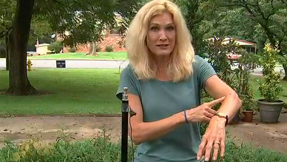 North Carolina man charged for shooting woman with a BB gun as she mistakenly grabbed his Trump lawn sign