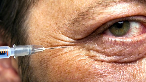 How the tech industry's youth culture is driving workers over 30 to plastic surgery