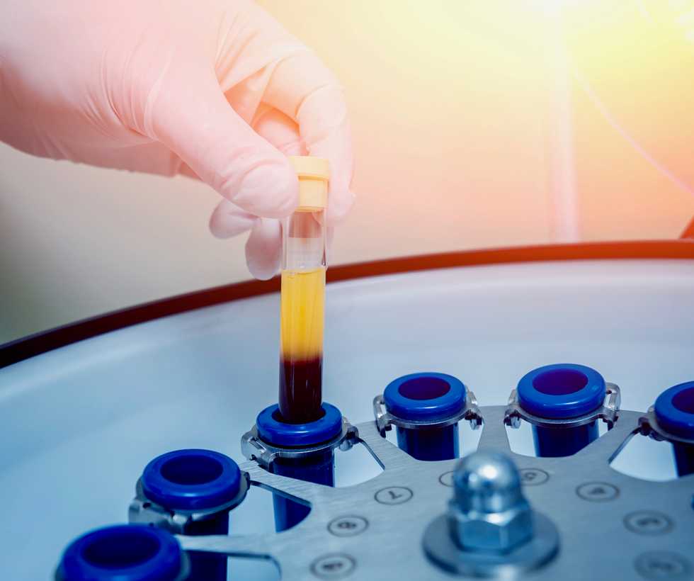 Convalescent plasma: What you need to know