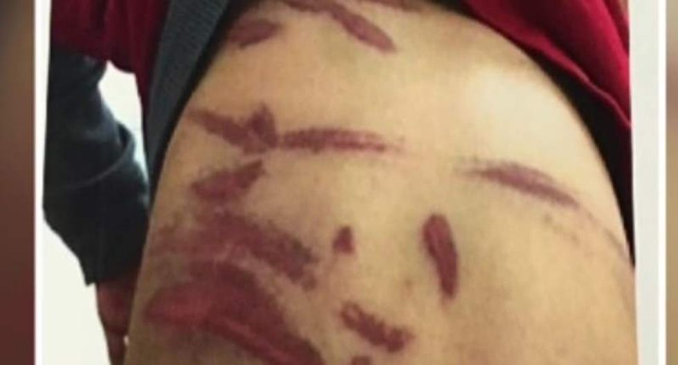 Indiana woman uses state 'religious freedom' law to justify lashing son with coat hanger