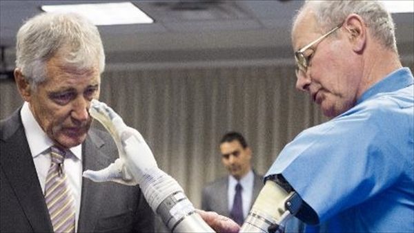 Advanced prosthetic arm approved for U.S. market after success with soldiers