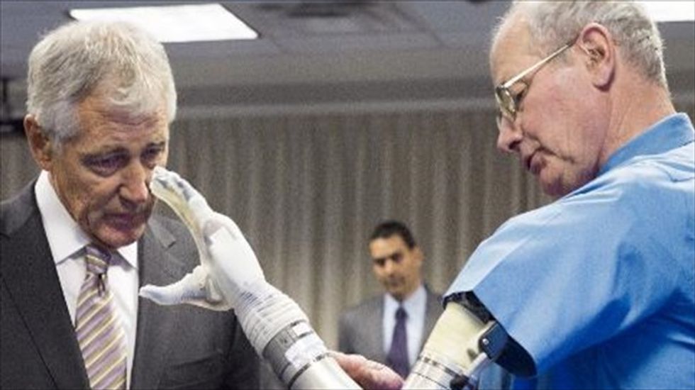 Advanced prosthetic arm approved for U.S. market after success with soldiers