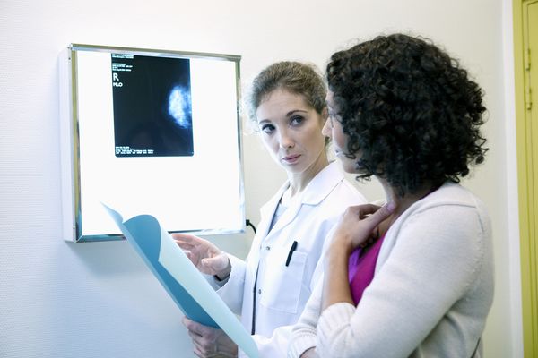 Skin moles may predict women's likelihood of developing breast cancer