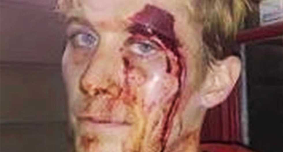 WATCH: Here's the damning video Missouri cops used to blow up white man's fake tale of assault by a black man