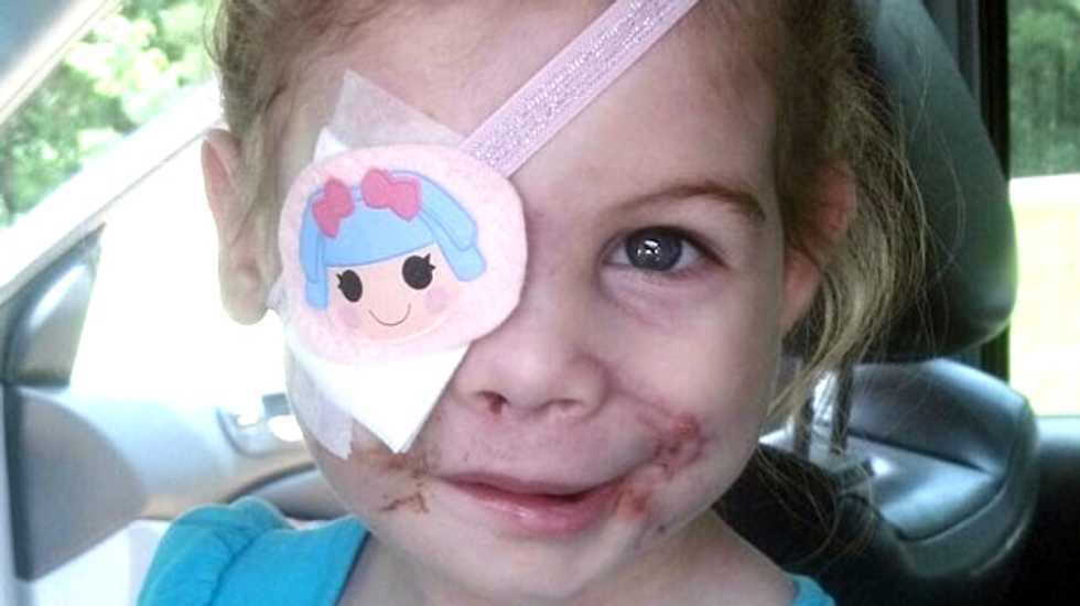 Hoax called on MS family raising money off claim that KFC kicked out disfigured girl