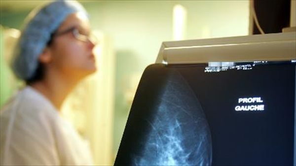 Researchers link gene mutation to patients' odds of beating breast cancer
