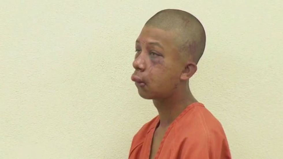 Florida father posts photo of sexually abused son online in donation plea