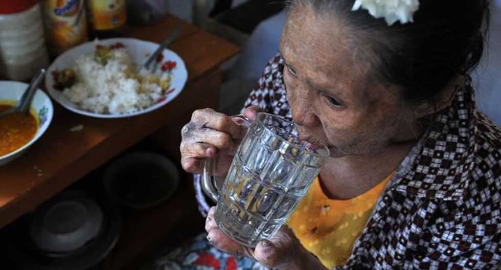 Ancient scourge? Myanmar still sees 3,000 new leprosy cases a year