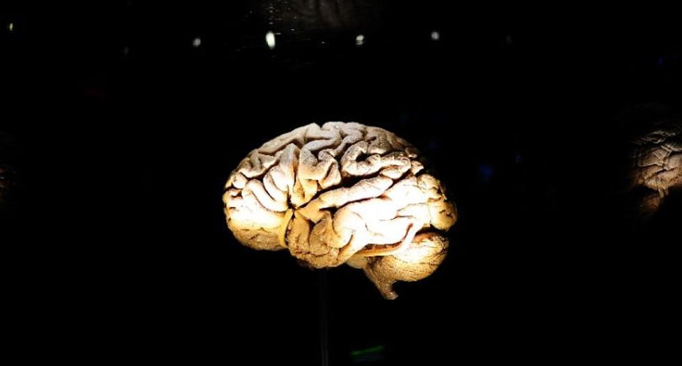 Dementia cases to nearly triple by 2050: report