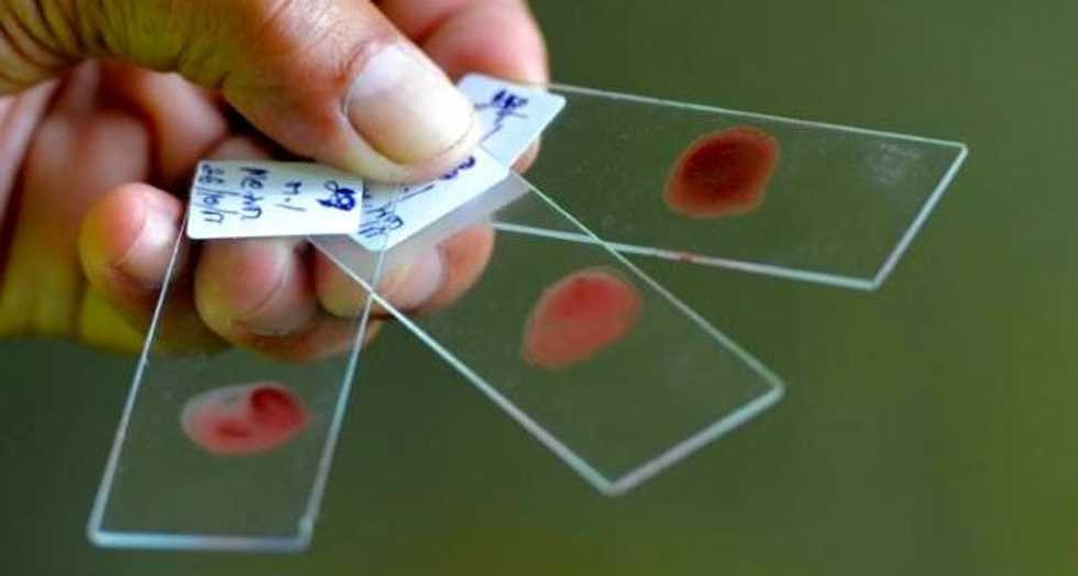 Blood test could predict breast cancer's return: study