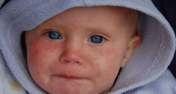 Here are 9 of the craziest claims made by anti-vaxxers