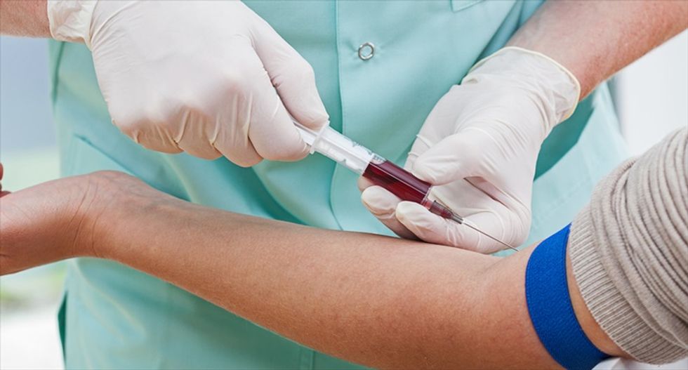Can we reverse the aging process by putting young blood into older people?